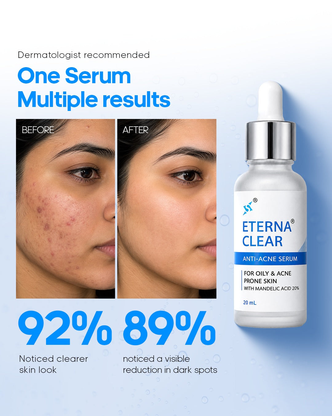 Eterna Clear - 20% Mandelic Acid
